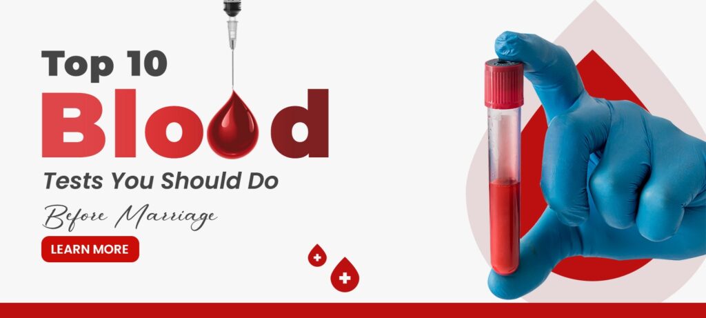 blood-tests-before-marriage