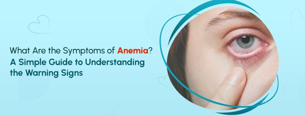Symtoms-of-Anemia