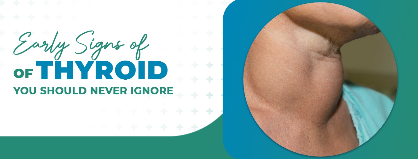 Thyroid Test in Behala